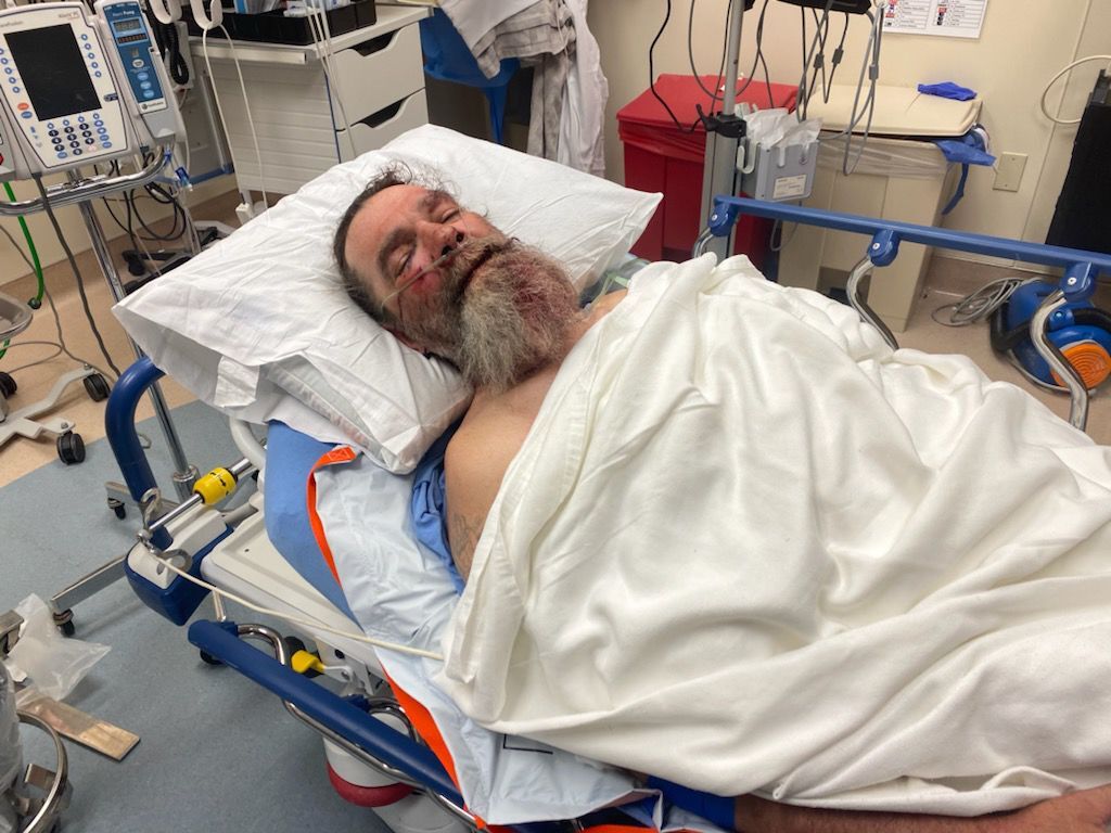 Edward Stevens injured in hospital
